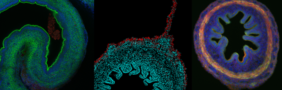 From left to right: ceca stained for laminin and dapi, Gut tube stained for laminin and dapi, gut tube stained for actin, pMLC, and DAPI