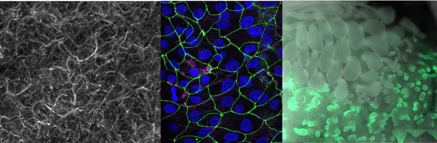 collage, membrane gfp with dapi, noggin featherbuds