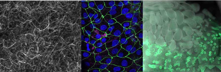 collage, membrane gfp with dapi, noggin featherbuds