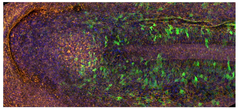 laminin and actin stained embryo