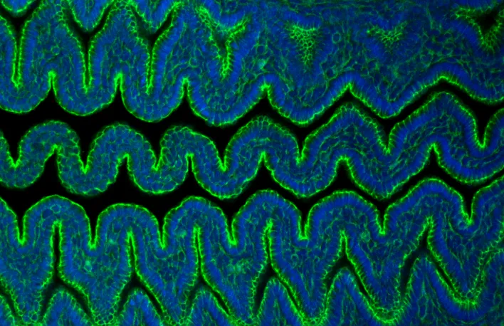 villi