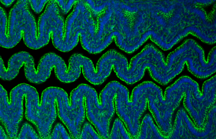villi