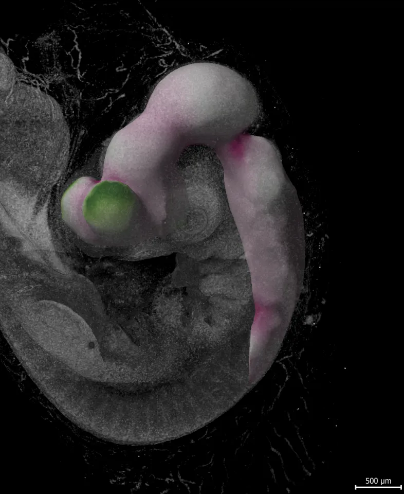 mechanobiology of early brain development
